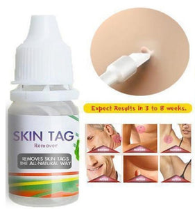 Skin Tag & Wart Treatment